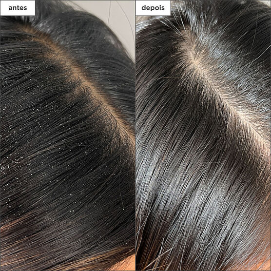 Scalp Revival Build-up Detox Spray